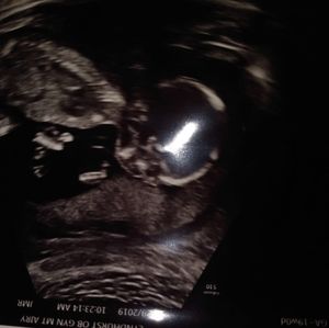 Meet your Posher, Dallas